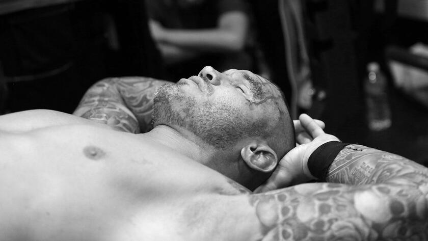 Randy Orton suffered a laceration to his head following a brutal assault by Brock Lesnar during their match at SummerSlam.