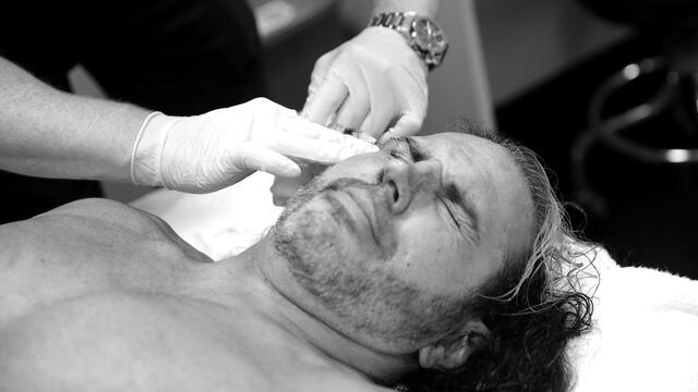 Graphic photos: Matt Hardy receives nine stitches at WWE Great Balls of Fire
