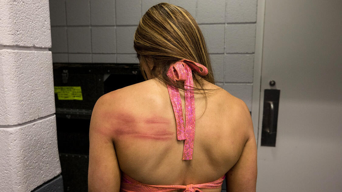 Alexa Bliss Kendo Stick Attack Leaves Marks On Mickie James Back Wwe